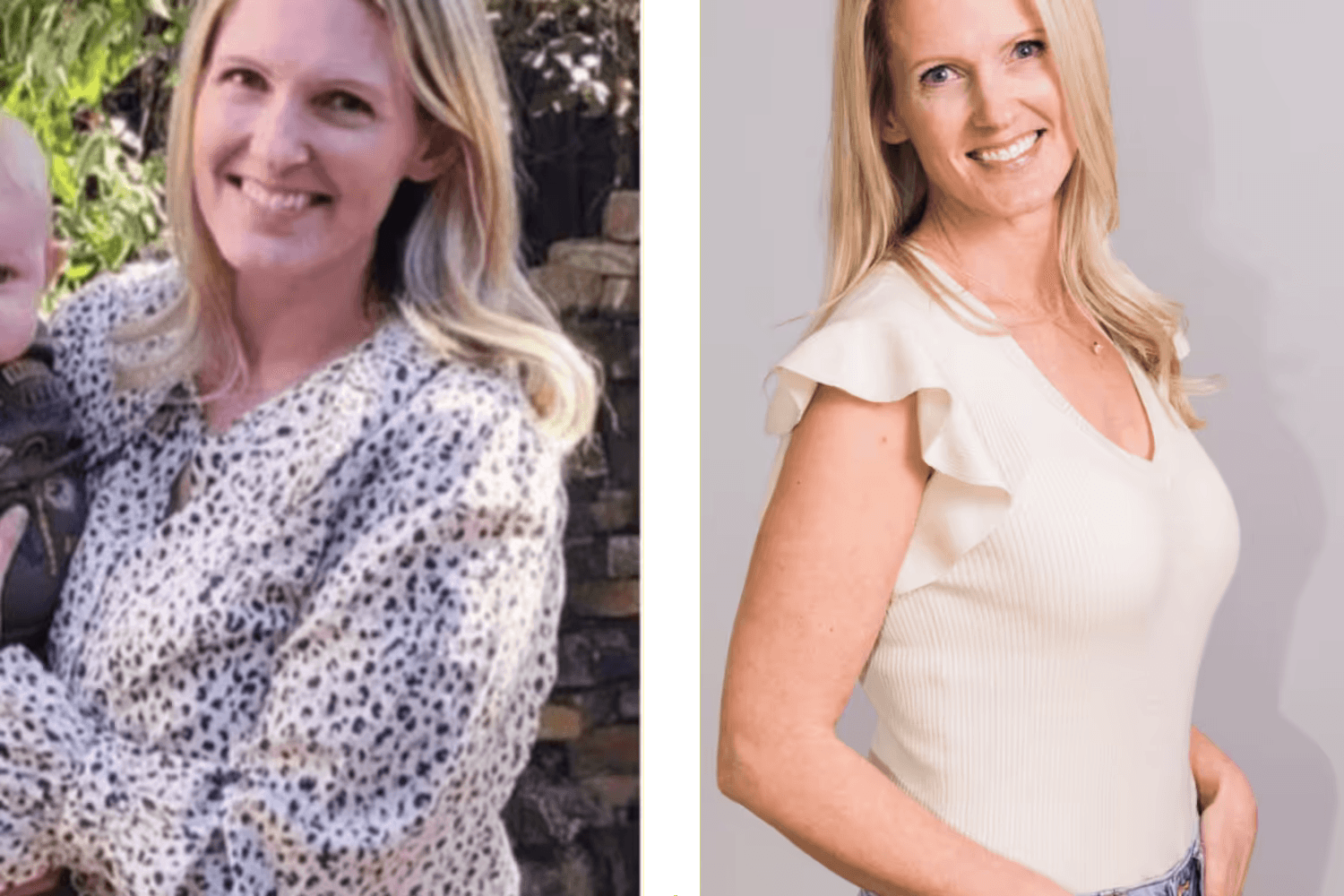 Patient transformation 7