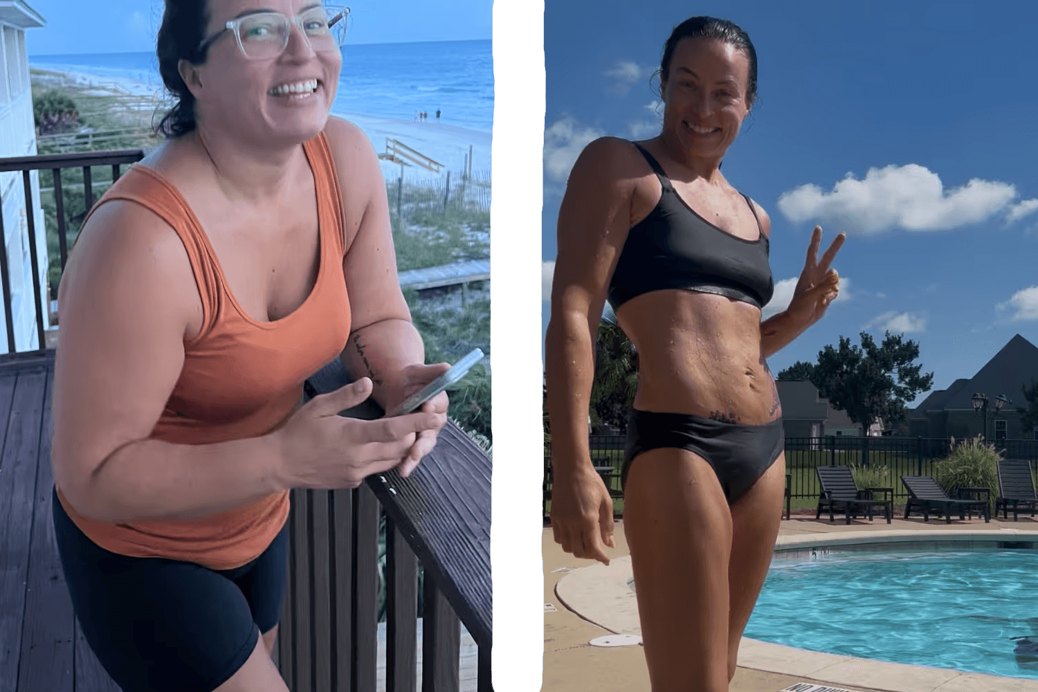 Patient transformation 5
